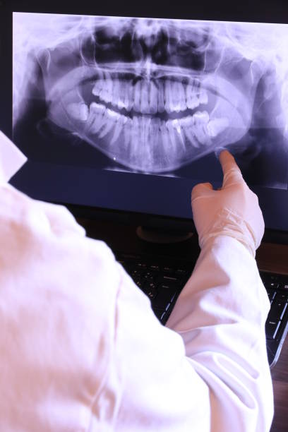 Best Emergency Dental Care for Broken or Chipped Teeth in Medina, TX