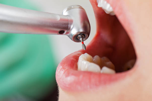 Best Urgent Care for Lost Fillings or Crowns in Medina, TX